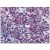 Immunohistochemistry: SM6009 CEBPB antibody staining of Formalin-Fixed, Paraffin-Embedded Human Tonsil at 10 µg/ml followed by biotinylated anti-Mouse IgG secondary antibody, Alkaline Phosphatase-Streptavidin and chromogen.