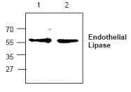 AP00307PU-N - LIPG