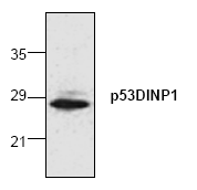 AP00101PU-N - TP53INP1