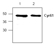 AP00299PU-N - CYR61