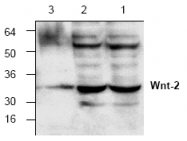 AP00246PU-N - WNT2
