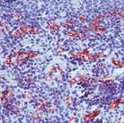 AP00503PU-N - Transglutaminase-2 (TGM2)