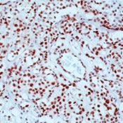 AM00202SU-N - Retinoblastoma-associated protein / RB1