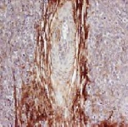 R1565 - Osteopontin / SPP1