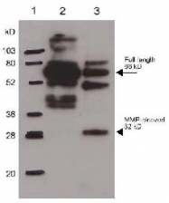 R1565 - Osteopontin / SPP1