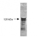 R1089 - Glycerol kinase