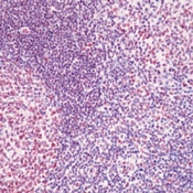AM00262PU-N - CBP/P300