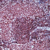 AM00262PU-N - CBP/P300