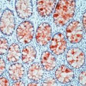 SM3092P - Blood Group Lewis b