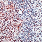 DM382 - E2F4