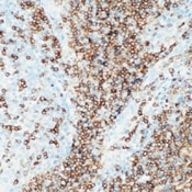 SM1098 - CD22