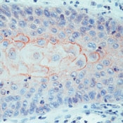 SM1111P - CD44v4