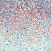 SM1118P - CD44v6