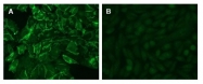 DM1204 - CD66e / CEACAM5
