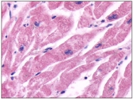 SP4069P - Beta-2 adrenergic receptor