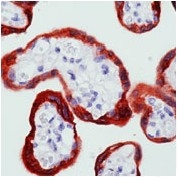 AM00309PU-N - ABL1