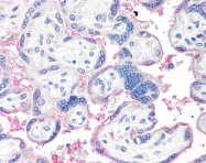 AP00001PU-N - Aromatase