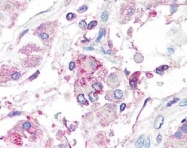 AP00001PU-N - Aromatase