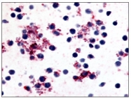 SP4456P - Prostacyclin receptor / PTGIR