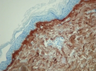 AF5810 - Collagen type III alpha 1 chain