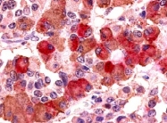 SP4534P - Vasopressin V1b receptor (V1bR)