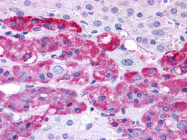SP4124P - Endothelin B receptor