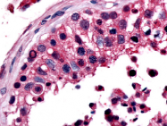 SP4131P - Estrogen-related receptor beta