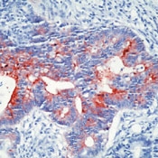 SM3073P - Human IgA