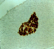 BM504S - Insulin