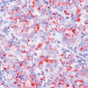 SM1573P - MYB
