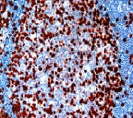 DM112 - CD3