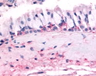 SP4606P - Olfactory receptor 10J5