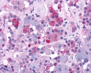 SP4659P - Vasopressin V1b receptor (V1bR)