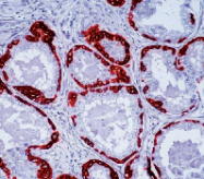 DM275-05 - basic Cytokeratin