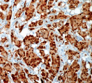 DM3097S - Heat shock protein 70 / HSP70