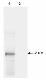 R1091P - GFP