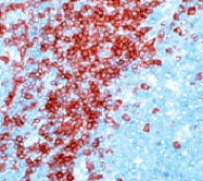 DP005 - CD3
