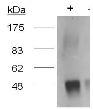 BP616 - MMP-9