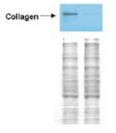 R1038 - Collagen type I
