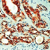 AM00560PU-N - VEGF-A