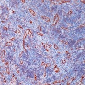 AM00616PU-N - Transglutaminase-2 (TGM2)