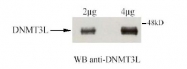 R1572P - DNMT3L