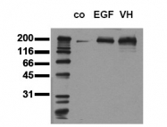 AM00042PU-N - EGFR / ERBB1
