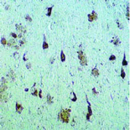 SP2104 - MAPT / TAU