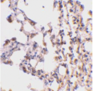 SP2115P - BID