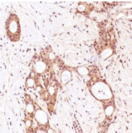 SP2066P - MLH1