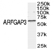 SP1402P - RHOU / ARHU