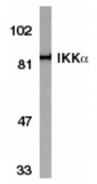 SP1509P - IKKA