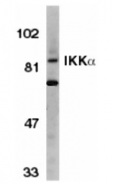 SP1268P - IKKA