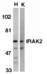 SP1272P - IRAK2